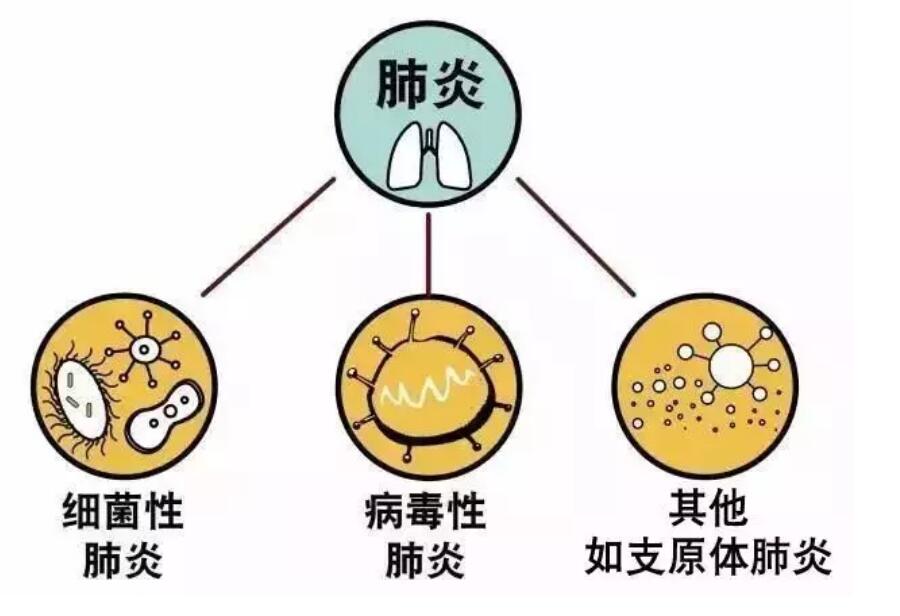 3歲女孩同時感染5種病原體