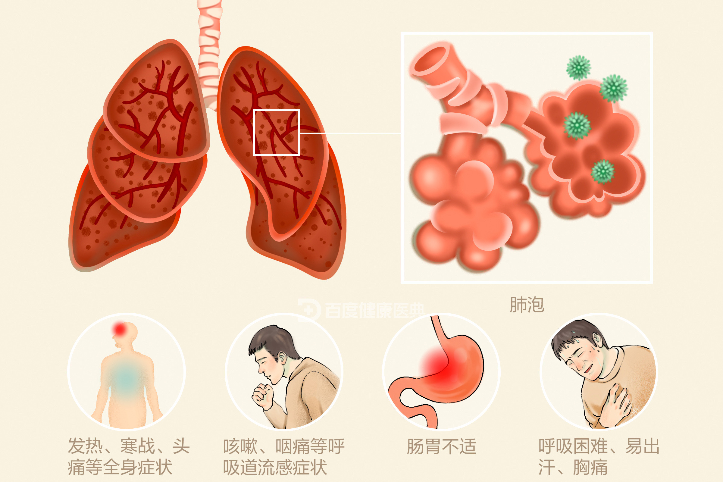 3歲女孩同時(shí)感染5種病原體