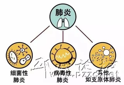 合胞病毒傳染性約是流感2.5倍