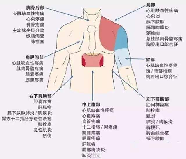 8歲男孩患肺炎支原體肺炎后突發(fā)腦梗